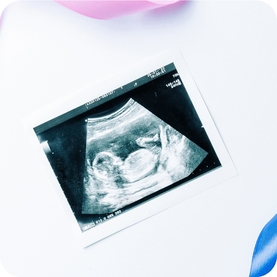 Herview Ultrasound Scan