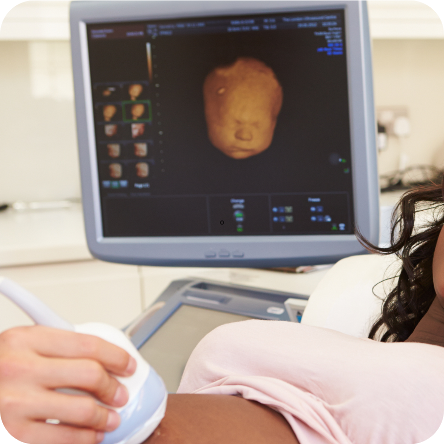 Herview Ultrasound Scan